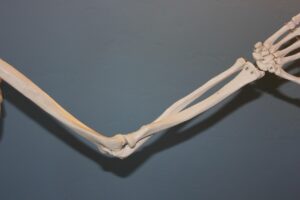 テニス肘初心者が知っておくべき原因と対策は？